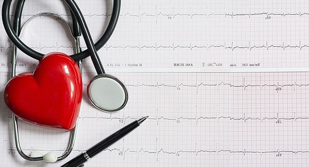 Wykres przedstawiający wyniki EKG serca